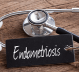 האם ייתכן שאת סובלת מאנדומטריוזיס?-תמונה